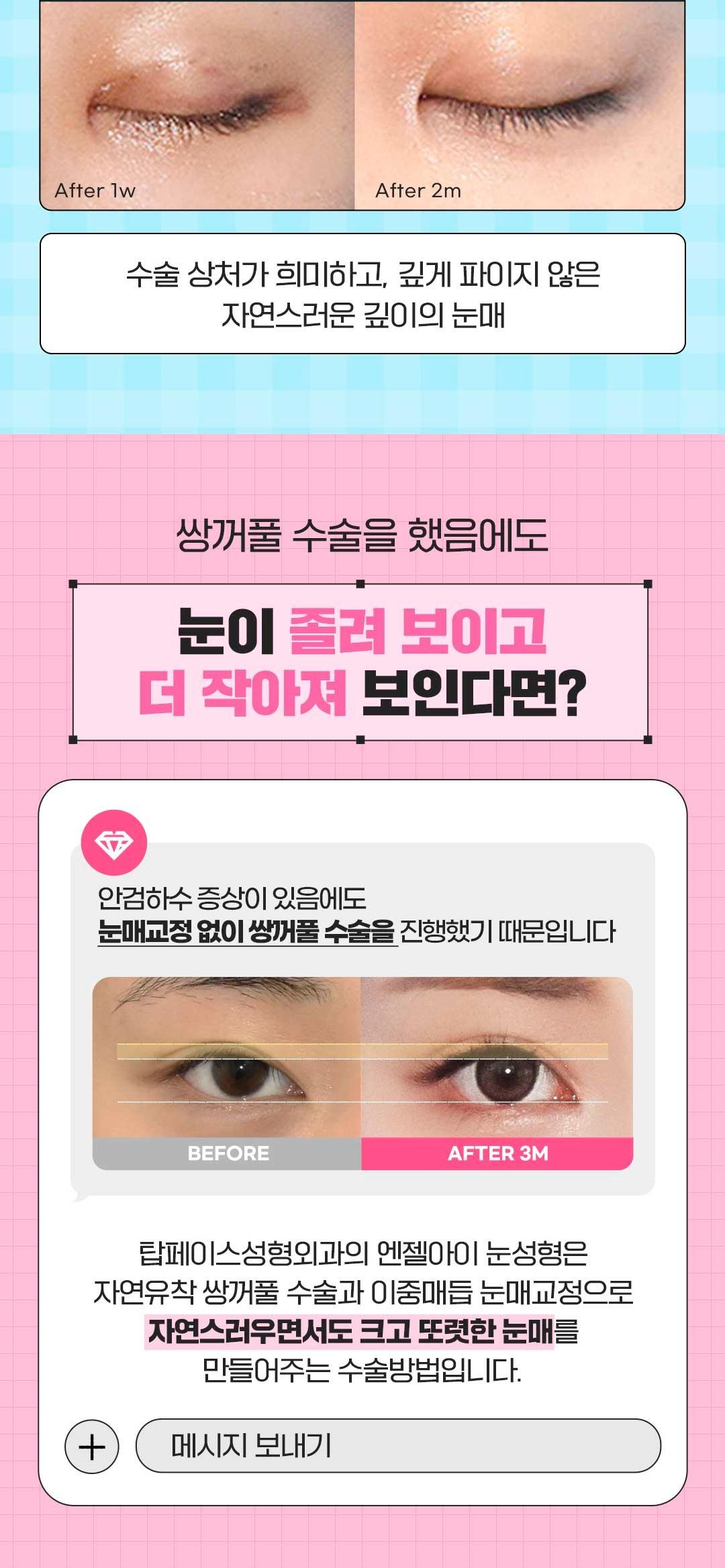 섹션 3