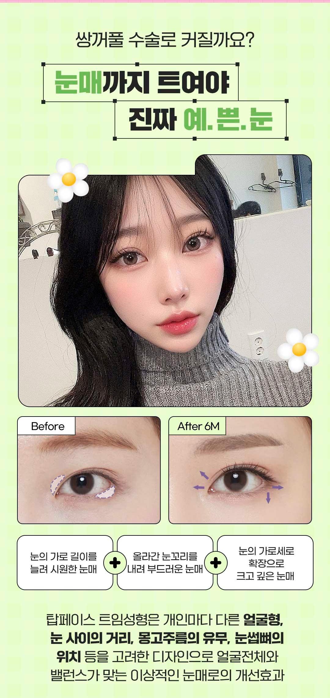 섹션 4
