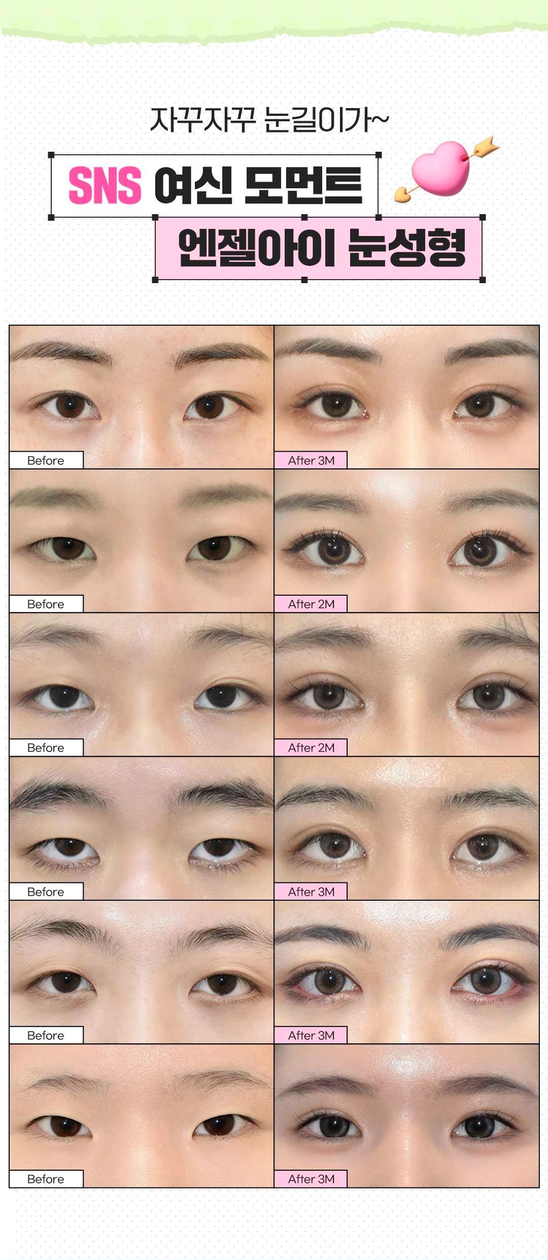 섹션 5
