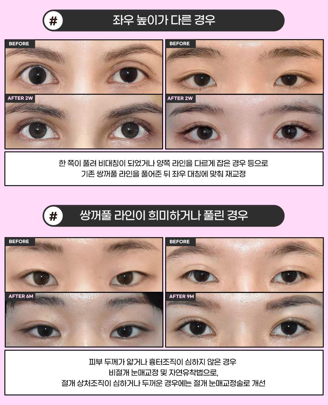 섹션 8