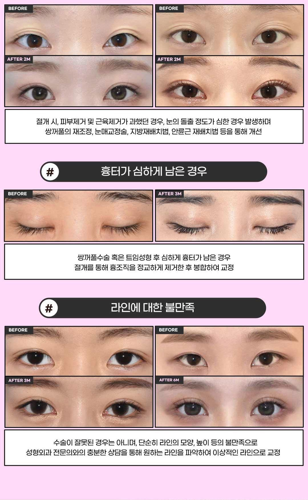 섹션 10